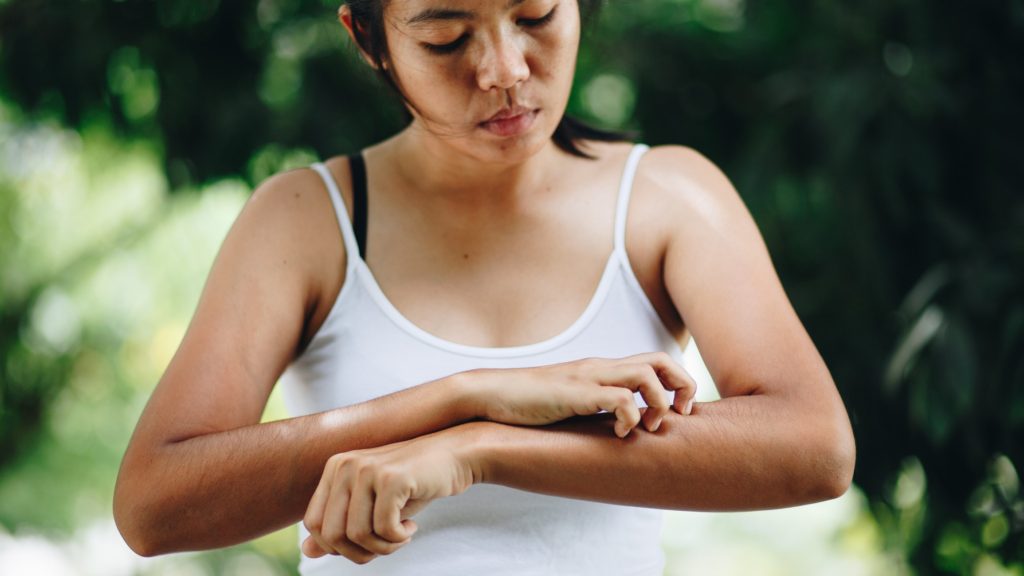 Girl scratching her skin due to hard water irritation